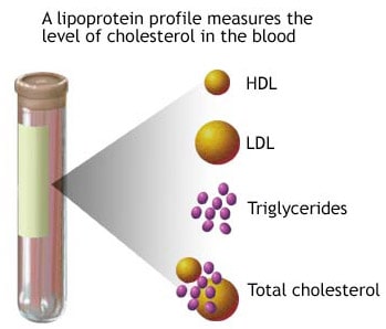Blood Cholesterol Testing - don't let the simple numbers fool you!